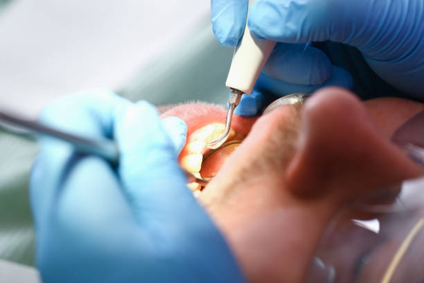 Best Emergency Orthodontic Repairs in Burlington, WA