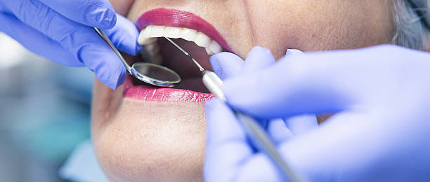 Best Weekend Emergency Dental Services in Burlington, WA